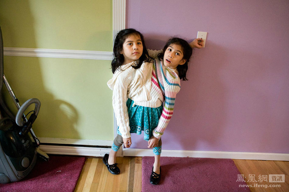 她们永远不会分开:一对墨西哥连体<em>姐妹</em> - <em>香港</em>