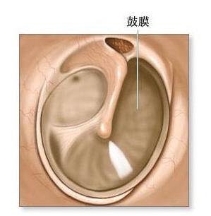 耳膜穿孔手术惊悚视频 耳膜穿孔手术有什么后