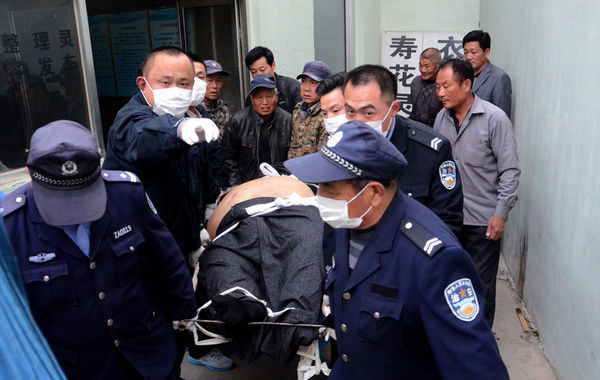 4月9日，孙亮因出现无明显诱因阴囊水肿3天，住进日照市人民医院，经过医生诊断，孙亮患有阴囊水肿、皮肤真菌感染、肥胖病、呼吸衰竭、心力衰竭、肝衰竭等一系列病症。20日下午2时许，孙亮由于心肺等器官衰竭，突然出现心率下降，医院随后抢救一个小时还是没有能够留住孙亮的生命，于下午3时许去世。