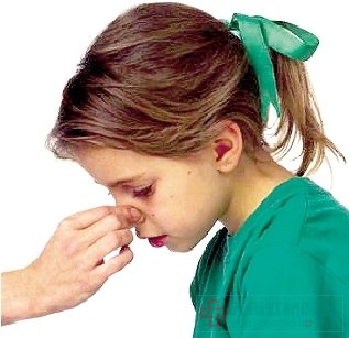 5岁女童患过敏性鼻炎 眼部瘙痒长出黑眼圈