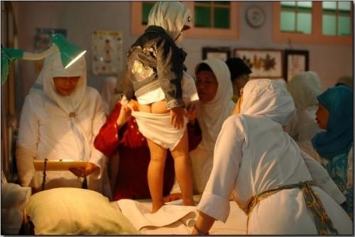 印尼女孩的割礼手术现场(图)