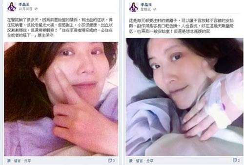 台主播李晶玉怀孕紧急出血 险些小产服安胎剂保孩子