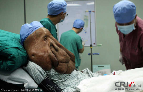 2013年12月25日，“象面人”黄春才在手术室准备接受手术治疗。图片来源:虞纵横/CFP