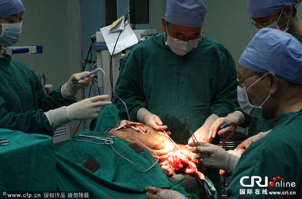 2013年12月25日，医生正在对黄春才左脸部巨瘤实施手术。图片来源:虞纵横/CFP