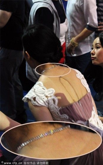 刘亦菲不慎露胸垫 玉背脚踝多蚊子包抢镜(图)