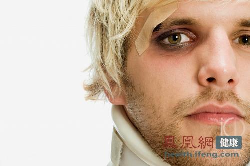 眼睛透视 从眼屎看出你患什么病