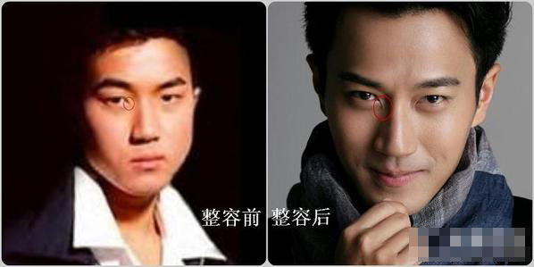 谁说整容是女星专利 盘点那些钟爱整容的男明星们