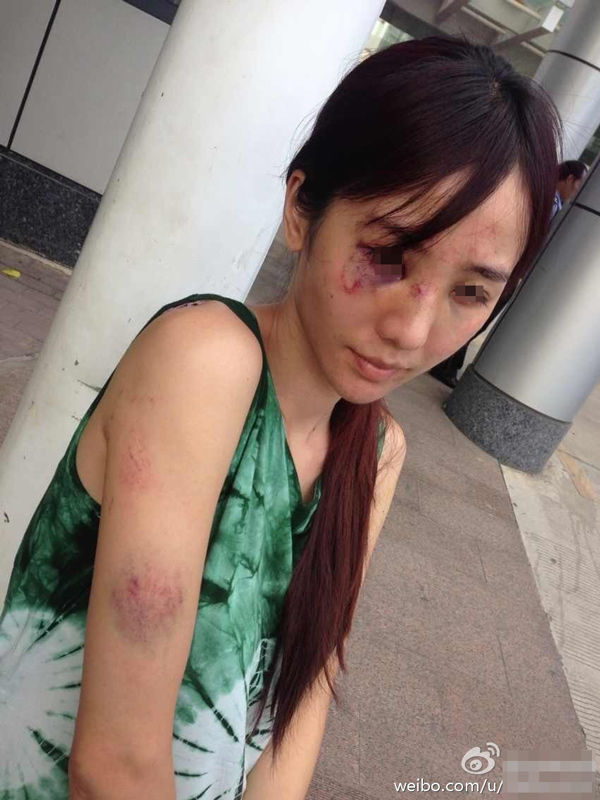 美女演员被家暴