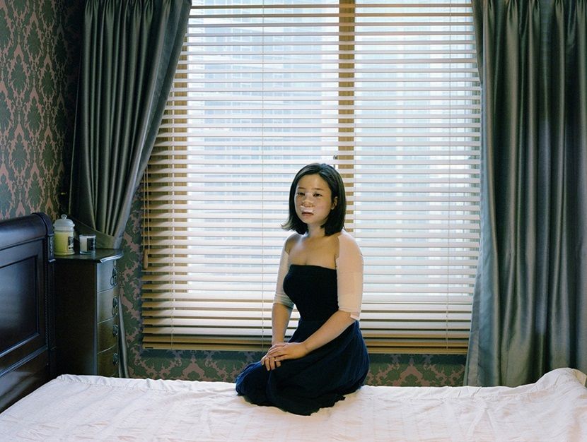 韩国医院内整容后的<em>女人</em> - 4G<em>视界</em>