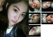 曝辽宁美女歌手拒陪酒遭毒打 脸部惨不忍睹