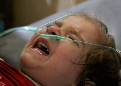 叙利亚政府军使用毒气攻击居民区