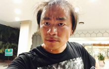 王宝强头发去哪了？