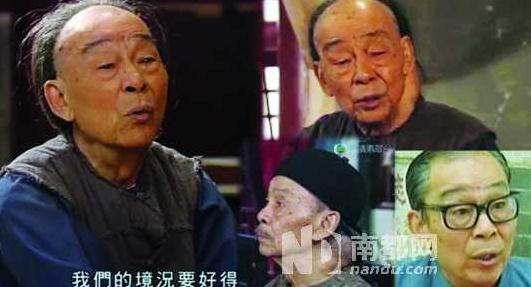 TVB老戏骨长巨型肿瘤拍戏:20年来已习惯(图)