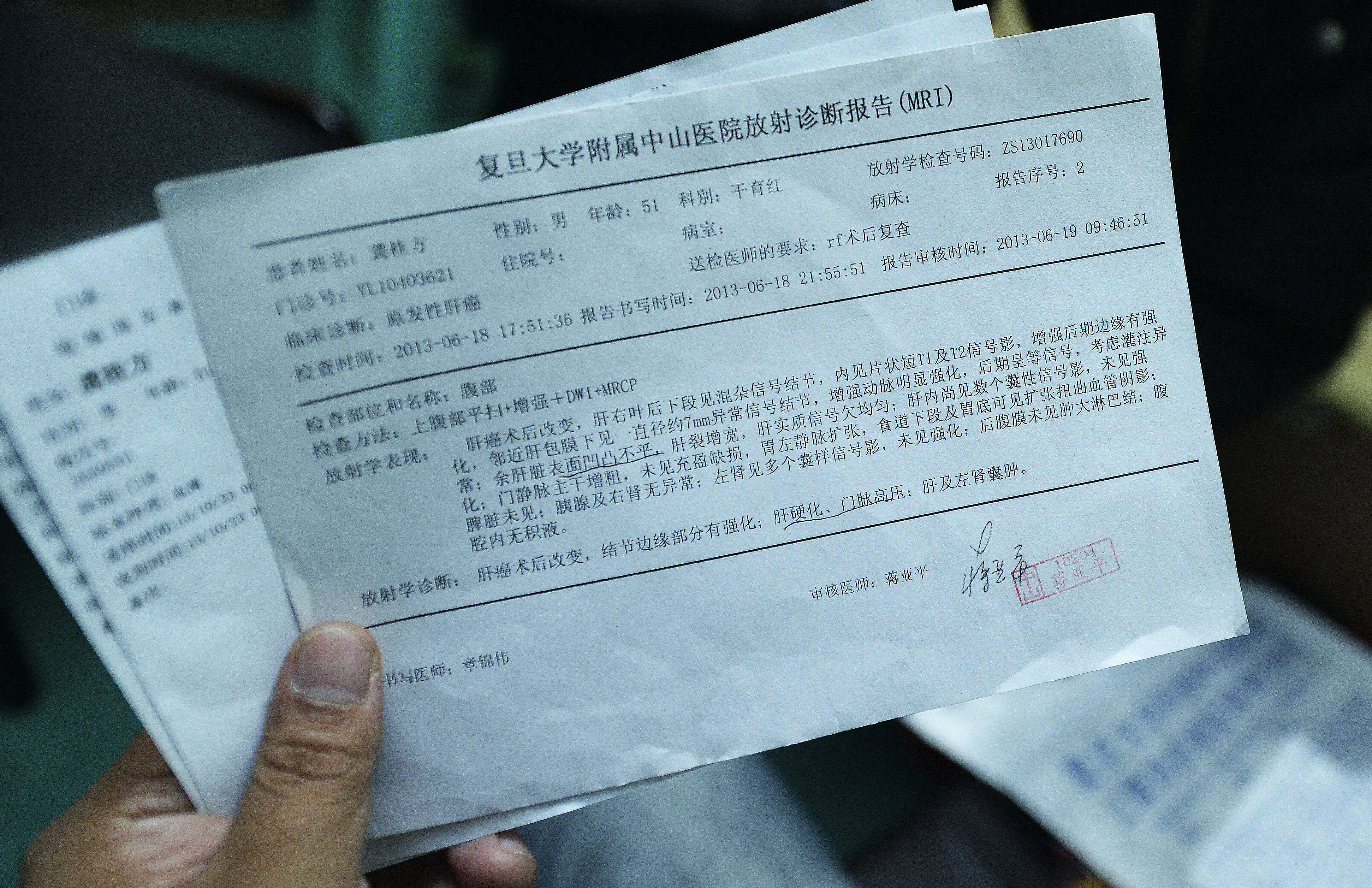 图为龚桂方保存着自己被确诊为"原发性肝癌"的化验单.
