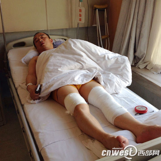 西安一男子路上被三蒙面人砍伤 曾称想竞选村