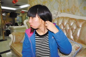 <em>揭阳</em>歪脸<em>女孩</em>将在深手术变脸|诊断|确诊_凤凰
