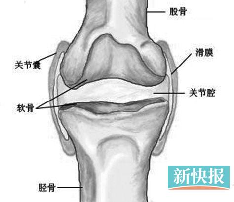关节退变、关节疼痛久拖不治后果严重|滑膜|