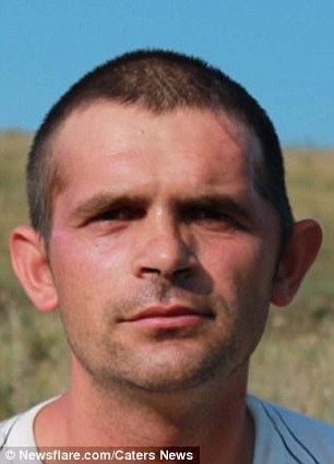 左边的图片是在埃尔维斯接受修复外科手术之前的样子。右边的图片则是他接受手术之后的样子,好心人们在了解到他的困境之后为其捐款791欧元(约为6542.36元人民币)。(图片来源:《每日邮报》)