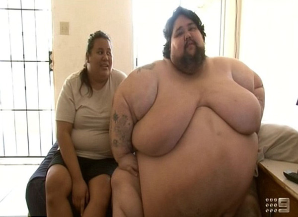 世界最胖男子纳普提曾被妻子谢丽尔照顾多年。