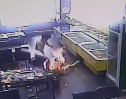 女孩吃烧烤烧伤 南京医生教你简单实用的自救