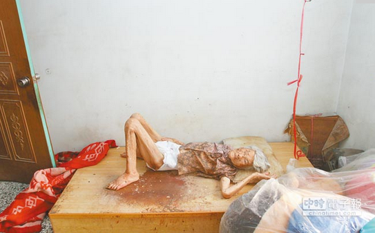 乏人照顾的徐金銮，原本被床头红绳绑住双手。林文煌摄图片来源：台湾《中时电子报》