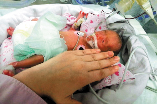 广东最袖珍婴儿抢救成功|宝宝|爸爸