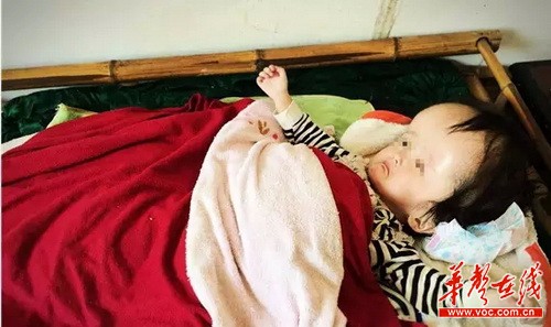 3岁的涵涵头长到成年人头部的2倍大，从半岁开始就躺在床上，无法动弹。