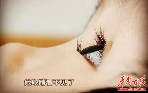 涵涵患脑积水，因视觉神经受到了压迫导致失明