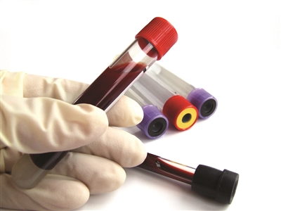 体检出“血液粘稠”要不要治