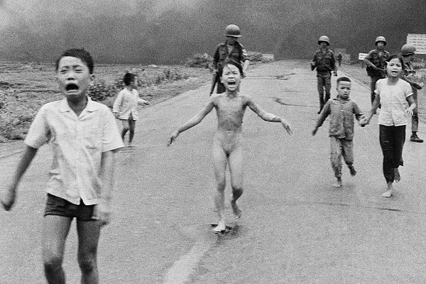 越战裸奔女童43年后接受激光治疗求脱苦海|女