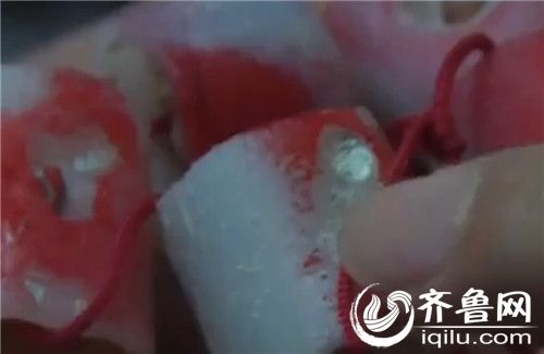 济南:工人上门维修越修越乱现代逸城业主有家