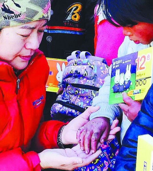 一双开裂的小手感动了李晋的朋友圈。图片来源：李晋