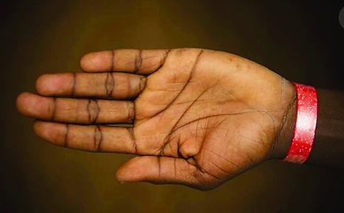 英公司让难民佩手环领食物引争议|难民|手环