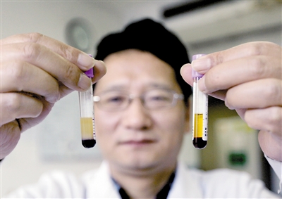 白血病血液样本(左)和正常血液样本对比。本报记者 雷键 摄