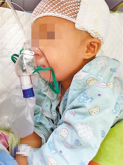 由于家长的疏忽,点点受到了不小的伤害。(医院提供)