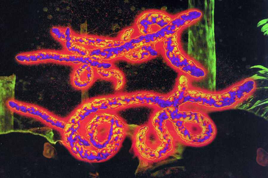 在沉寂多年之后，埃博拉病毒疫情今年2月在几内亚暴发，已经迅速蔓延至利比里亚等西非国家,导致672人死亡,这是自1976年该病毒首次爆发以来最严重的一次。近日，美国两名志愿者医生在埃博拉重灾国之一利比里亚感染上该病毒。目前可能正在向英国传染。