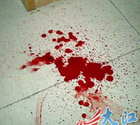 男生凌晨上网被敲破头