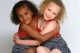 居住在英国达德利的一对双胞胎奇恩和雷米长相大不相同。奇恩的肤色是黑的，长着一双棕色的眼睛，而雷米却是金发白肤，长着蓝眼珠。这对黑白姐妹花出生的几率仅有百万分之一。
