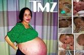 2009年1月，33岁的美国加州女子纳迪娅·苏莱曼成功产下八胞胎，整个分娩过程仅持续5分钟，这也是世界上第二例八胞胎全部存活的记录。这张令人感到吃惊的照片上显示的是，33岁的母亲在八胞胎出生8天前，露出大得惊人的肚子站在照相机前。苏利曼是一位单亲母亲，之前她已经通过试管受精生育 6个孩子。