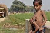 7岁男童巴斯旺绰号“奥克托男孩”，出生于印度最落后的地区之一，印度北部比哈省的一个村庄。生下来时，他腹部连着一个寄生连体婴，也就是说，他有4只脚与4只手，但只有一个头。