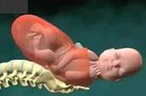胎儿的头已经完全出来，现在是肩膀出来。胎儿的头又转了方向


