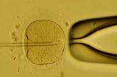  体外受精阶段最为关键的工序，在培养器皿里如果精子自己的力气不够，医生还会助精子一臂之力，把它送进卵子之内，使卵子变成受精卵。