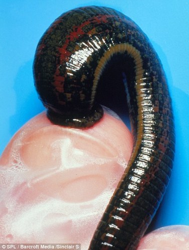 自然界真实存在吸血鬼:阴虱寄身于人体(组图)