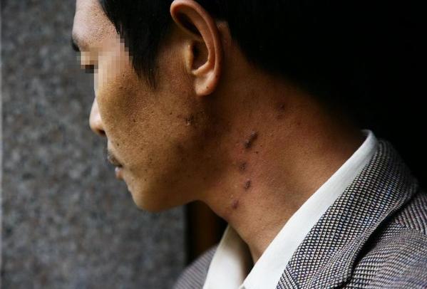 一门三父子_父子三人均感染艾滋(2)