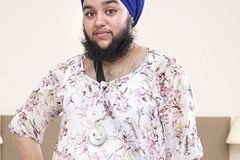 英国23岁女子长满脸络腮胡