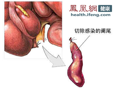 盘点人体最没用的十大器官(图)