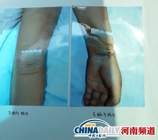 河南19岁<em>少女</em>死于戒网瘾学校 遍<em>体</em>鳞伤-<em>手机</em>凤