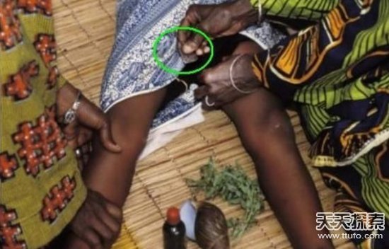 满12岁将强制"开苞" 4,非洲地区:女子成人礼上要进行残忍"割礼"  割礼