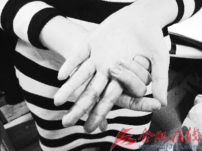 做完实验后，记者手上的蓝色无法清洗干净　