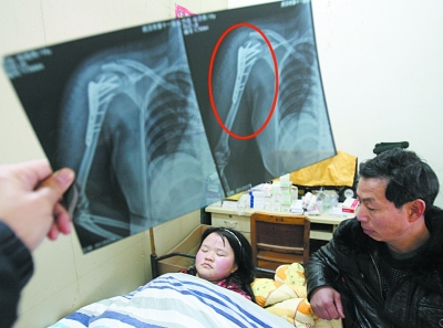 张群生守在女儿的病床前。记者石一 摄